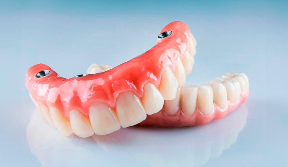 Próteses dentárias