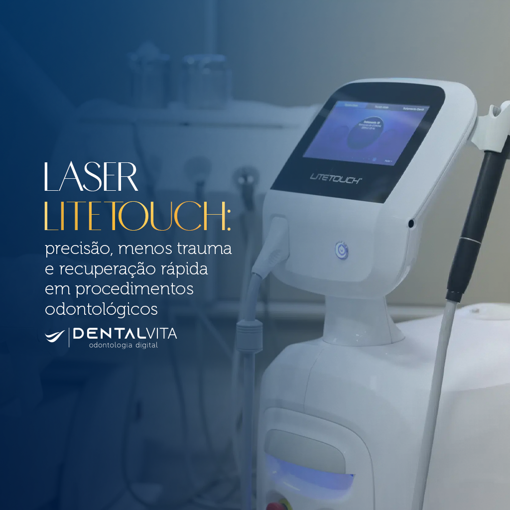 No momento, você está visualizando Laser LiteTouch: precisão, menos trauma e recuperação rápida em procedimentos odontológicos