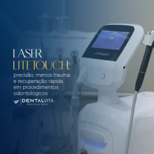 Leia mais sobre o artigo Laser LiteTouch: precisão, menos trauma e recuperação rápida em procedimentos odontológicos